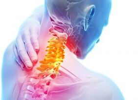Bolest a přístřešky v děložní zóně s třetím stupněm osteochondrosy